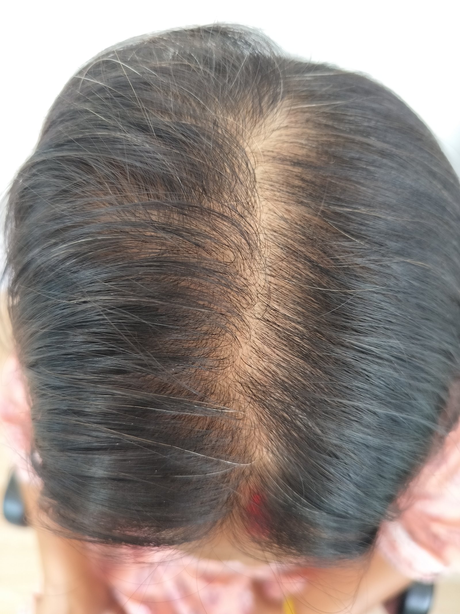 transformation-img-1