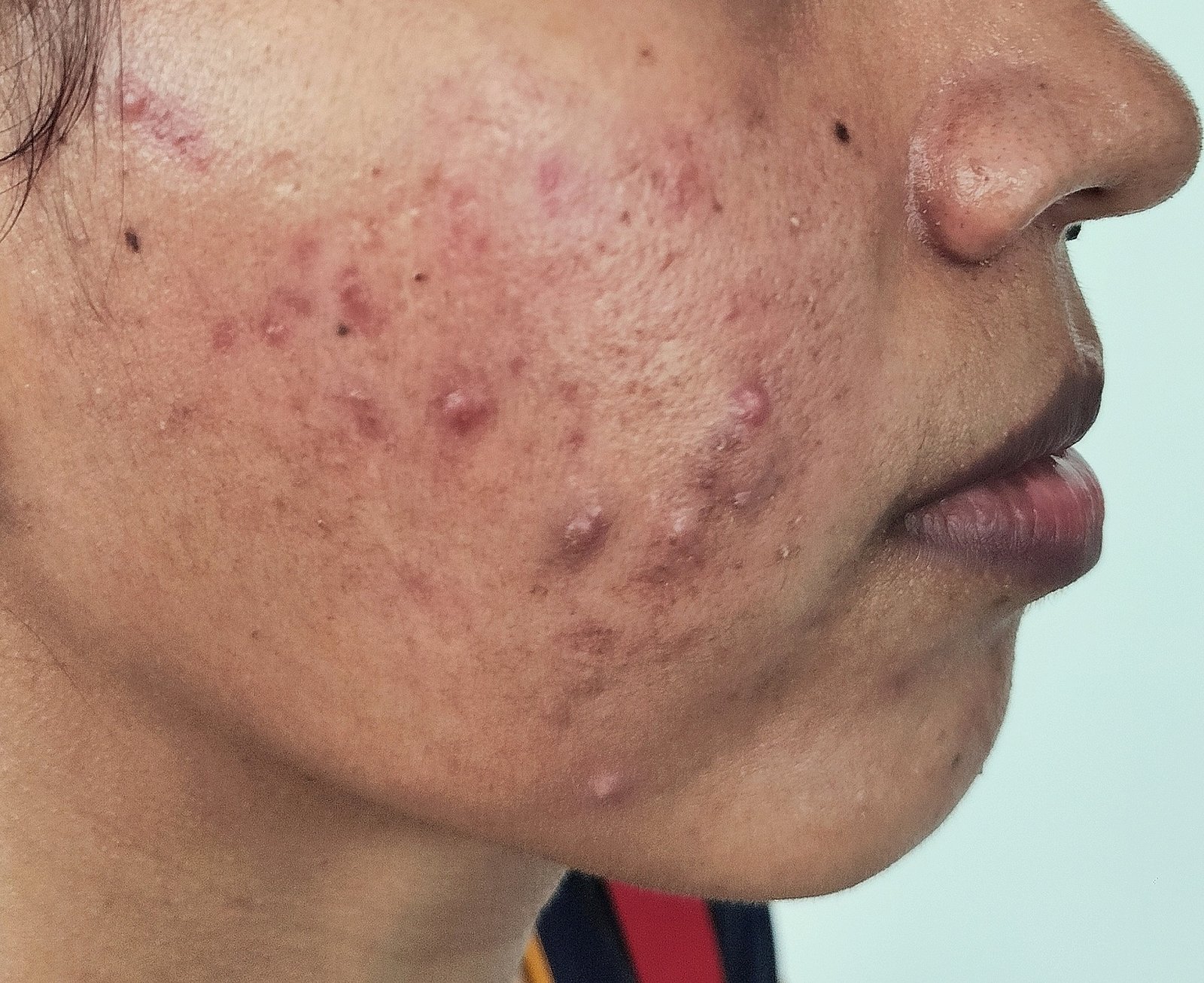 transformation-img-1